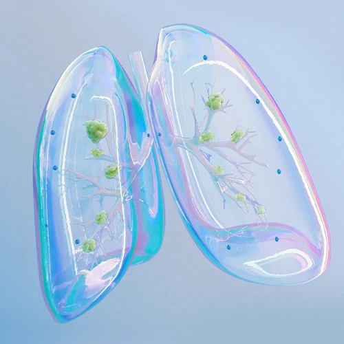 Kobieta siedząca w łóżku między zużytymi chusteczkami, dmucha nos